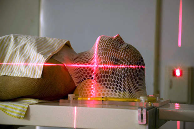 radioterapia-not-4509358