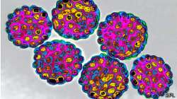 130721152335_hpv2_304x171_spl